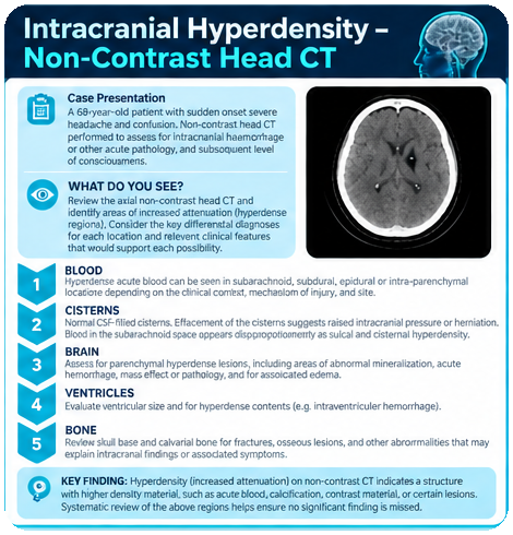 Intracranial Hyperdensity – Non-Contrast Head CT sample page